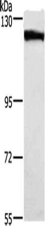 Western Blot analysis of Human tongue cancer tissue using DSG1 Polyclonal Antibody at dilution of 1:750