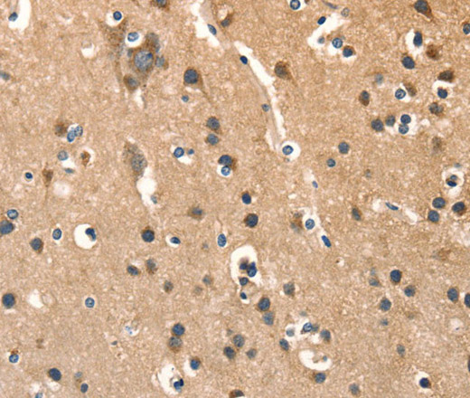 Immunohistochemistry of paraffin-embedded Human brain  tissue using AGO1 Polyclonal Antibody at dilution 1:40