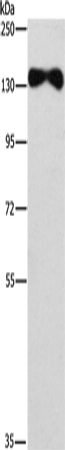 Western Blot analysis of Human placenta tissue using EVC2 Polyclonal Antibody at dilution of 1:450