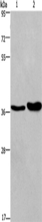 Western Blot analysis of Human testis tissue and transitional cell carcinoma of bladder tissue   using FUT1 Polyclonal Antibody at dilution of 1:250