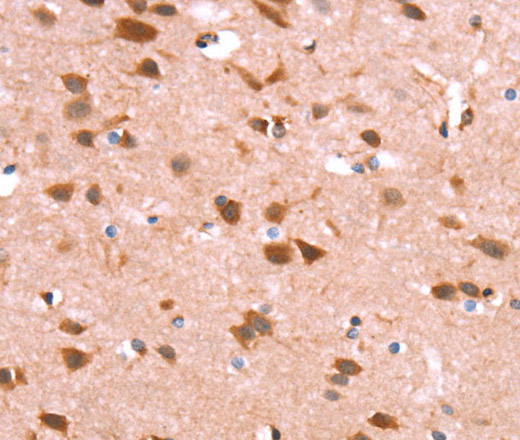 Immunohistochemistry of paraffin-embedded Human brain using GH1 Polyclonal Antibody at dilution of 1:40