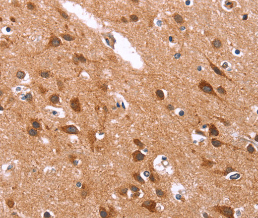 Immunohistochemistry of paraffin-embedded Human brain  tissue using GLMN Polyclonal Antibody at dilution 1:40