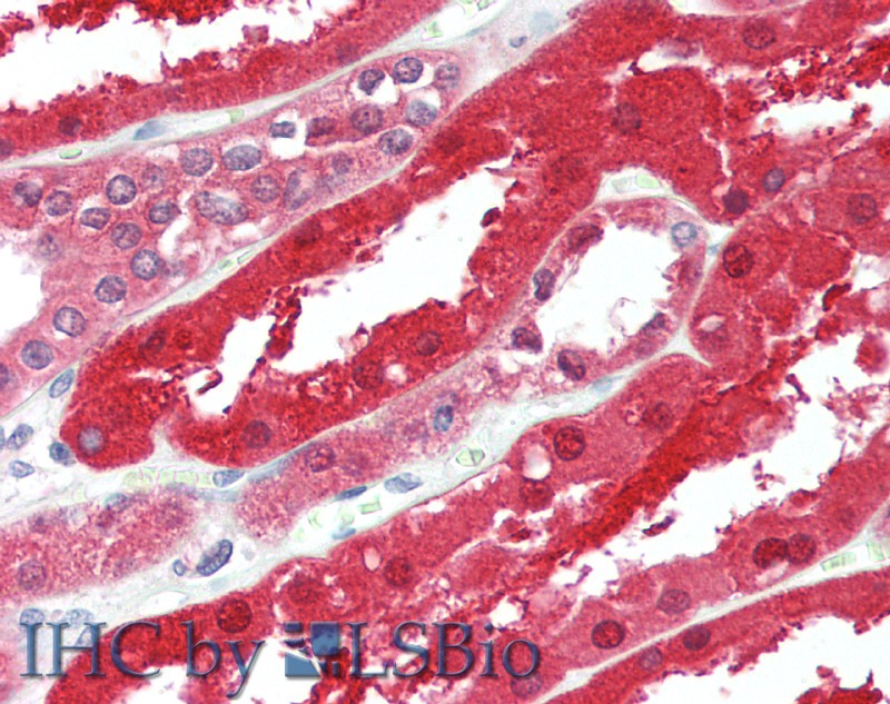 Immunohistochemistry of paraffin-embedded Kidney tissue using GPC6 Polyclonal Antibody at dilution of 1:90.