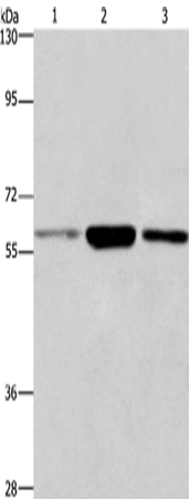 Western Blot analysis of K562,231,Human fetal liver tissue using GPC6 Polyclonal Antibody at dilution of 1:700