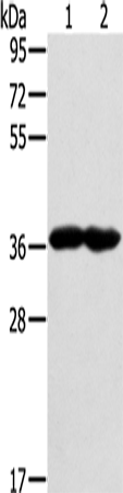 Western Blot analysis of Mouse heart and muscle tissue using GNAT3 Polyclonal Antibody at dilution of 1:400