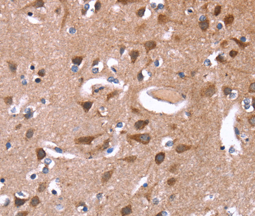 Immunohistochemistry of paraffin-embedded Human brain  tissue using GREB1 Polyclonal Antibody at dilution 1:50