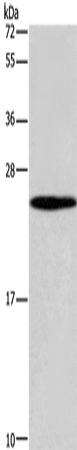 Western Blot analysis of 231 cell using GUK1 Polyclonal Antibody at dilution of 1:400