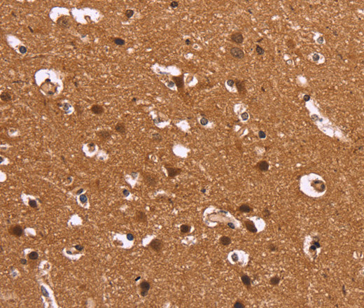 Immunohistochemistry of paraffin-embedded Human brain  using HDLBP Polyclonal Antibody at dilution of 1:50