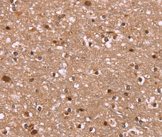 Immunohistochemistry of paraffin-embedded Human brain  tissue using HLTF Polyclonal Antibody at dilution 1:40