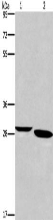 Western Blot analysis of Mouse brain tissue and A172 cell using NRG1 Polyclonal Antibody at dilution of 1:650