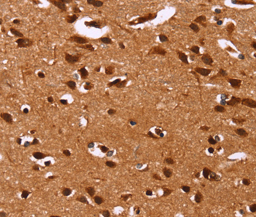 Immunohistochemistry of paraffin-embedded Human brain tissue using HRK Polyclonal Antibody at dilution 1:40