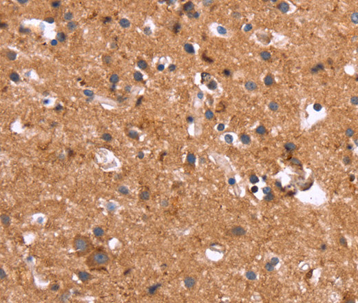 Immunohistochemistry of paraffin-embedded Human brain using HSD17B1 Polyclonal Antibody at dilution of 1:40