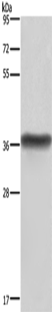 Western Blot analysis of Human placenta tissue  using HSD17B1 Polyclonal Antibody at dilution of 1:600