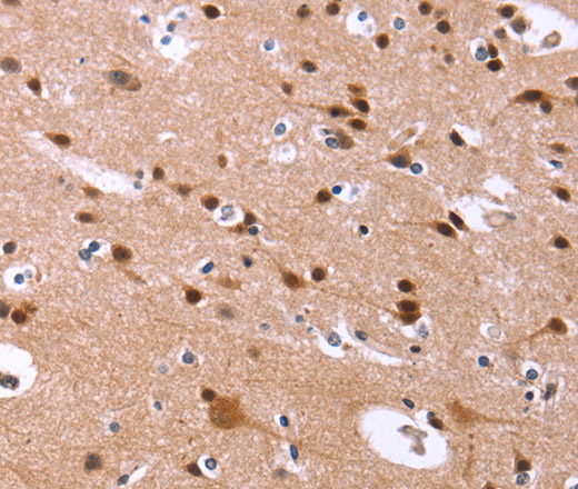 Immunohistochemistry of paraffin-embedded Human brain  tissue using ID4 Polyclonal Antibody at dilution 1:40