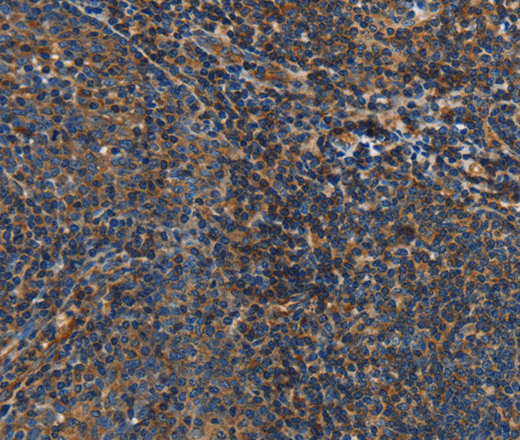 Immunohistochemistry of paraffin-embedded Human tonsil tissue using IL17D Polyclonal Antibody at dilution 1:50