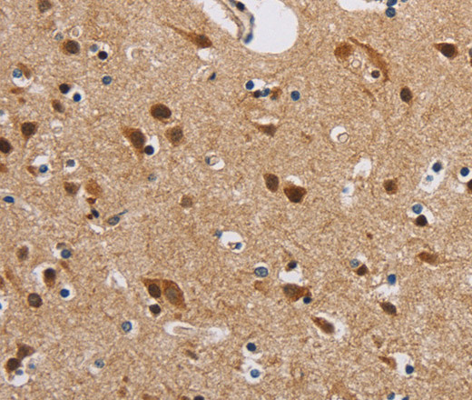 Immunohistochemistry of paraffin-embedded Human brain  using IL19 Polyclonal Antibody at dilution of 1:40