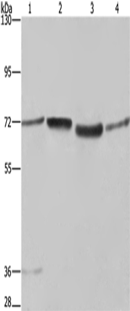 Western Blot analysis of A375 and 231 cell, 293T cell and Human hepatocellular carcinoma tissue  using SYN1 Polyclonal Antibody at dilution of 1:550