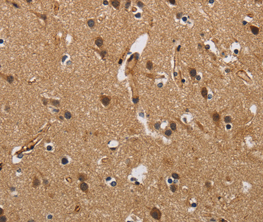 Immunohistochemistry of paraffin-embedded Human brain  using FABP2 Polyclonal Antibody at dilution of 1:40