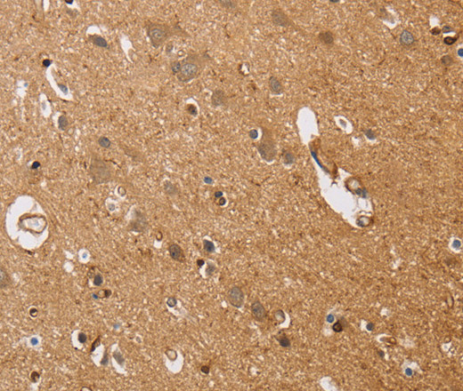 Immunohistochemistry of paraffin-embedded Human brain  tissue using ITPR1 Polyclonal Antibody at dilution 1:40