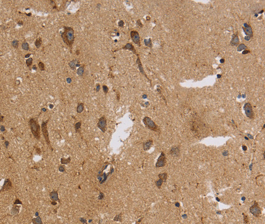 Immunohistochemistry of paraffin-embedded Human brain tissue using ITPR3 Polyclonal Antibody at dilution 1:30