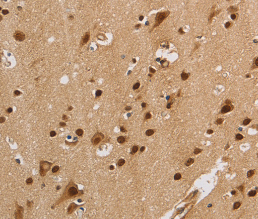 Immunohistochemistry of paraffin-embedded Human brain  using KCNG4 Polyclonal Antibody at dilution of 1:40