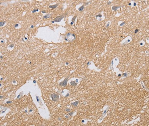 Immunohistochemistry of paraffin-embedded Human brain using KCNMB3 Polyclonal Antibody at dilution of 1:40