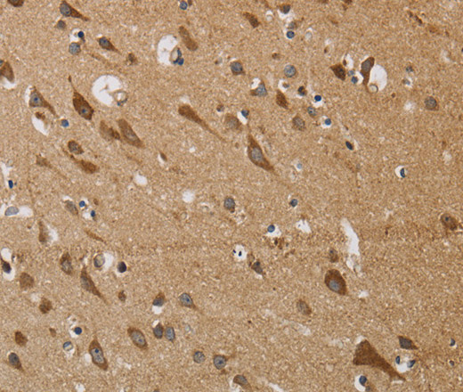 Immunohistochemistry of paraffin-embedded Human brain  using KCNMB4 Polyclonal Antibody at dilution of 1:30