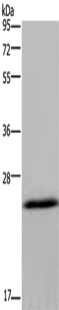 Western Blot analysis of Mouse brain tissue using KCNMB4 Polyclonal Antibody at dilution of 1:500