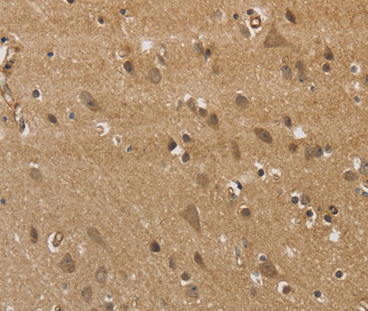 Immunohistochemistry of paraffin-embedded Human brain using KCNN4 Polyclonal Antibody at dilution of 1:40