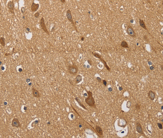 Immunohistochemistry of paraffin-embedded Human brain  using KCNQ4 Polyclonal Antibody at dilution of 1:40