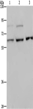 Western Blot analysis of A431, MCF-7 and Hela cell using KIF22 Polyclonal Antibody at dilution of 1:200