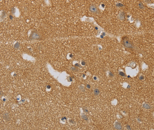 Immunohistochemistry of paraffin-embedded Human brain tissue using KIF4A Polyclonal Antibody at dilution 1:40