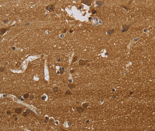 Immunohistochemistry of paraffin-embedded Human brain tissue using ELAVL2 Polyclonal Antibody at dilution 1:40