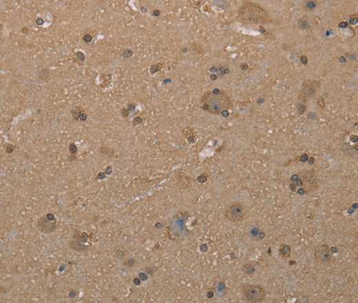 Immunohistochemistry of paraffin-embedded Human brain using CAB39 Polyclonal Antibody at dilution of 1:40