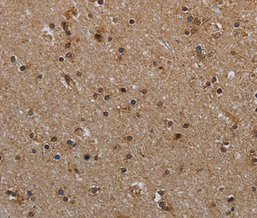 Immunohistochemistry of paraffin-embedded Human brain  tissue using MYO7A Polyclonal Antibody at dilution 1:30