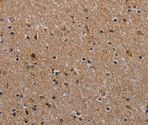 Immunohistochemistry of paraffin-embedded Human brain  using NDUFA8 Polyclonal Antibody at dilution of 1:40