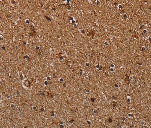 Immunohistochemistry of paraffin-embedded Human brain  tissue using NDUFAB1 Polyclonal Antibody at dilution 1:40