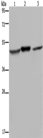 Western Blot analysis of Mouse heart and brain tissue, Jurkat cell using NDUFS2 Polyclonal Antibody at dilution of 1:400