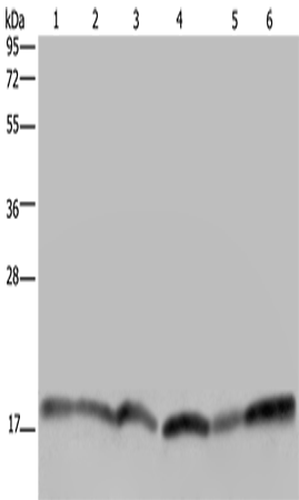 Western Blot analysis of Human brain malignant glioma tissue, Jurkat, Raji and 231 cell, Human fetal brain tissue and Hela cell using RHEB Polyclonal Antibody at dilution of 1:300