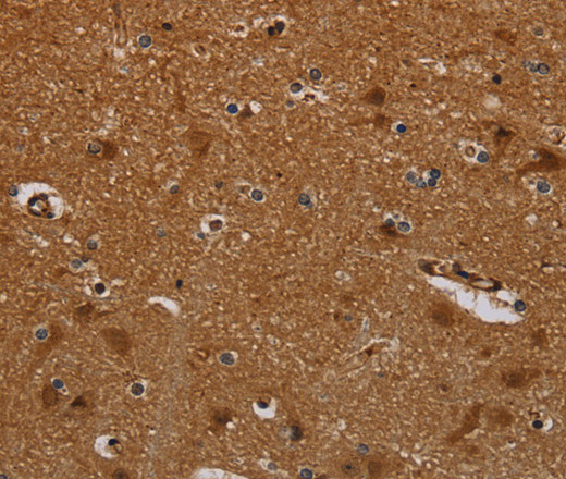 Immunohistochemistry of paraffin-embedded Human brain  tissue using PNOC Polyclonal Antibody at dilution 1:40