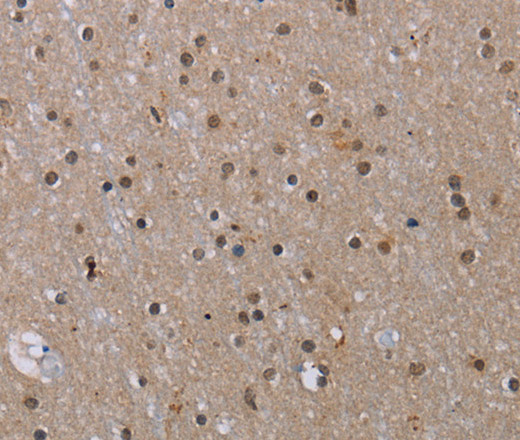 Immunohistochemistry of paraffin-embedded Human brain tissue using MED12 Polyclonal Antibody at dilution 1:40