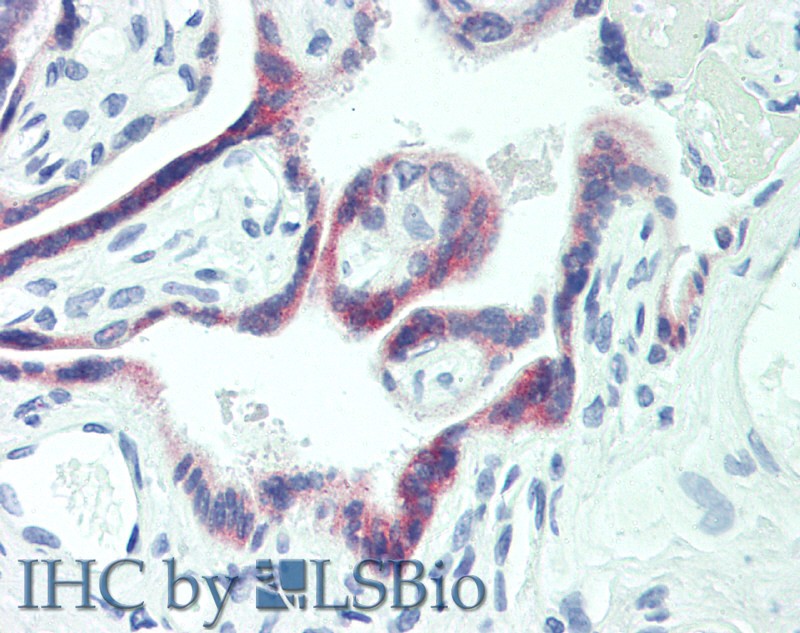 Immunohistochemistry of paraffin-embedded Human Placenta tissue using PAPPA Polyclonal Antibody at dilution of 1:100.