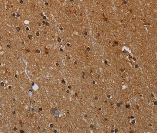 Immunohistochemistry of paraffin-embedded Human brain  tissue using PARP8 Polyclonal Antibody at dilution 1:40