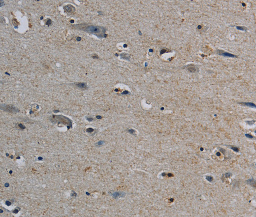 Immunohistochemistry of paraffin-embedded Human brain tissue using PERK Polyclonal Antibody at dilution 1:50