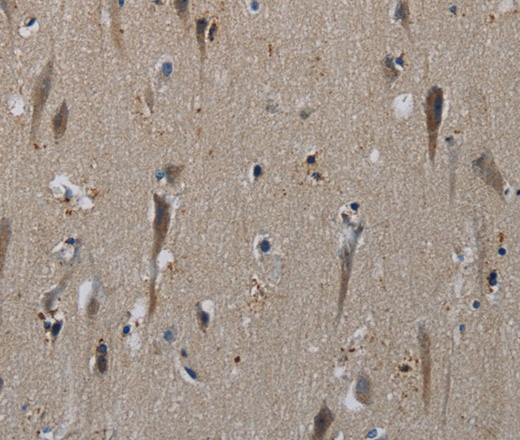 Immunohistochemistry of paraffin-embedded Human brain  tissue using HSPG2 Polyclonal Antibody at dilution 1:50