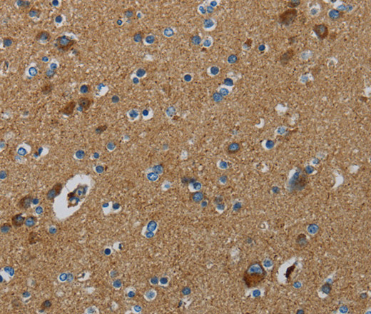 Immunohistochemistry of paraffin-embedded Human brain  tissue using PPARGC1B Polyclonal Antibody at dilution 1:30