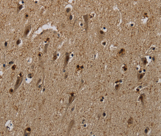 Immunohistochemistry of paraffin-embedded Human brain  tissue using PNN Polyclonal Antibody at dilution 1:50