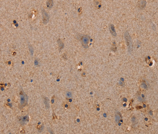 Immunohistochemistry of paraffin-embedded Human brain  tissue using PLXNA1 Polyclonal Antibody at dilution 1:30