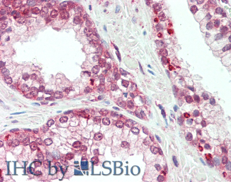 Immunohistochemistry of paraffin-embedded Prostate tissue using PLXNB1 Polyclonal Antibody at dilution of 1:60.