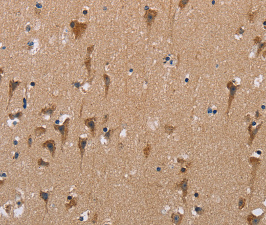 Immunohistochemistry of paraffin-embedded Human brain  using POMT1 Polyclonal Antibody at dilution of 1:50